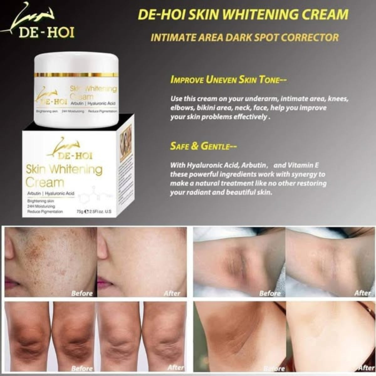 DE HOI Skin Whitening Cream – Face & Body Brightening – 75g