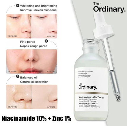 The Ordinary Niacinamide 10% + Zinc 1% Serum 30ml for Bright & Clear Skin