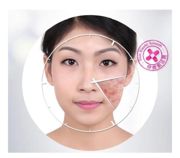 BioAqua Anti Acne & Scar Removal Cream – 30g (Original)