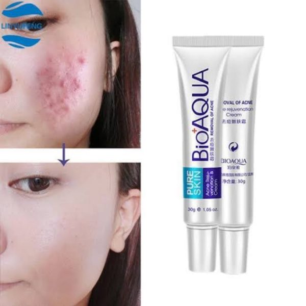 BioAqua Anti Acne & Scar Removal Cream – 30g (Original)