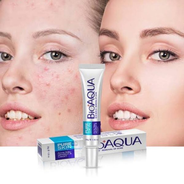 BioAqua Anti Acne & Scar Removal Cream – 30g (Original)