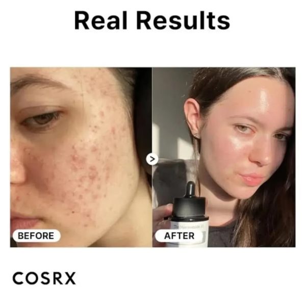COSRX Hyaluronic Acid 3% Hydrating Face Serum – 20ml